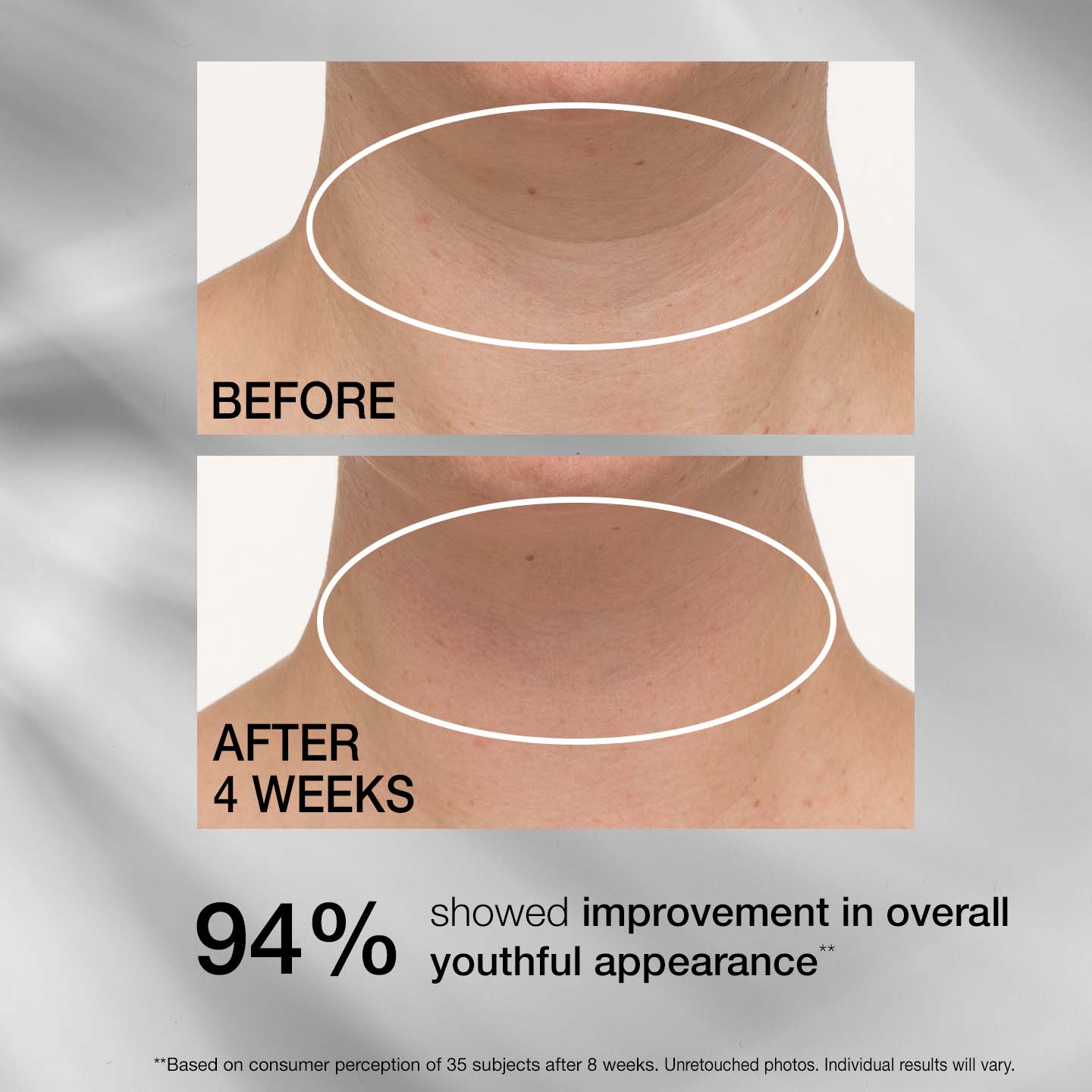 TL LOVILDS® Tightening Neck Cream PLUS