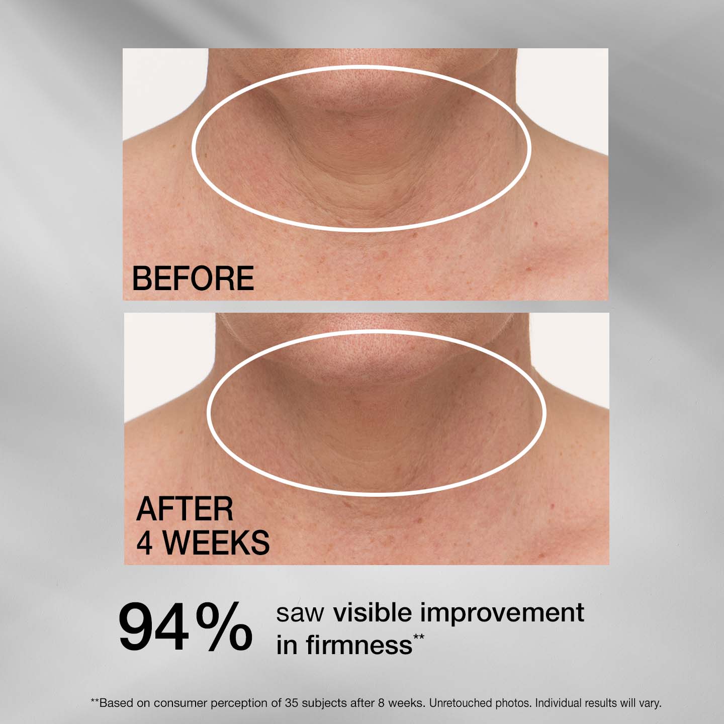 TL LOVILDS® Tightening Neck Cream PLUS
