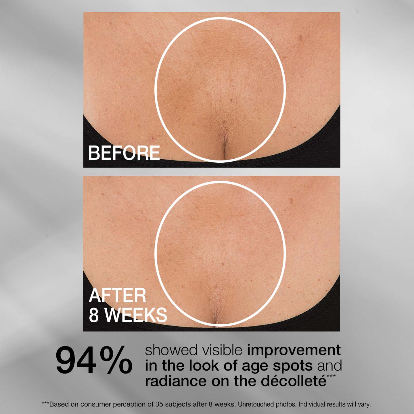 TL LOVILDS® Tightening Neck Cream PLUS